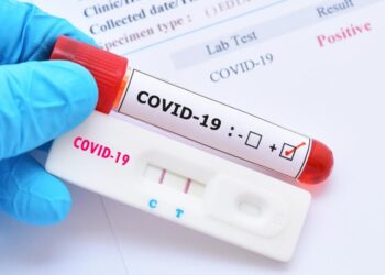 Falsification of COVID-19 test results untrue – Noguchi