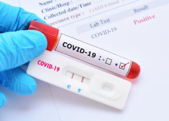 Ghana begins digital verification of Covid-19 test results