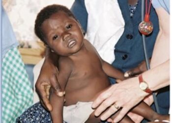 15,000 new born babies annually have sickle cell diseases – Doctor