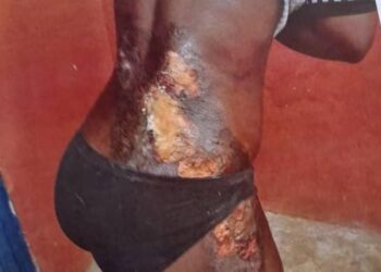 Mother pours hot water on daughter for taking her GH¢5.00 for food
