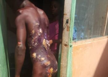 Mother wickedly pours hot water on son’s body; locks him in room for days – Photos