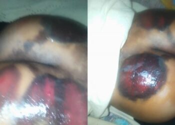 3 Teachers mercilessly beat the hell out of JHS 3 student over classwork