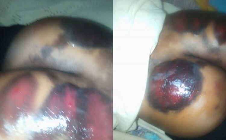 3 Teachers mercilessly beat the hell out of JHS 3 student over classwork