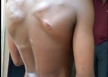 B/R: Father, 2 teachers beat 14-year-old boy to pulp over absenteeism