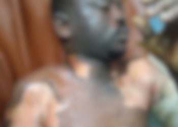 W/R: Man sets fellow ablaze for calling out wife’s private part