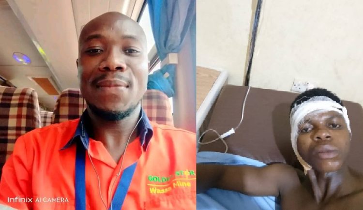 W/R: Man, 39 bites off bar attendant’s ear at Waasa Togbekrom