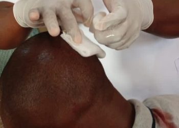 E/R: NDC thugs attack NPP supporters in Upper Manya Krobo over DRIP equipment