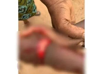 A/R: Man, 64, slashes 9-year old boy’s wrist over sugarcane