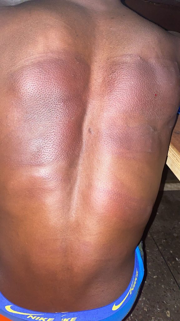 One of the physically assaulted victims