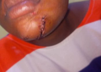 Kasoa: Gold dealer ‘hammers’ girlfriend to near-death over suspected infidelity