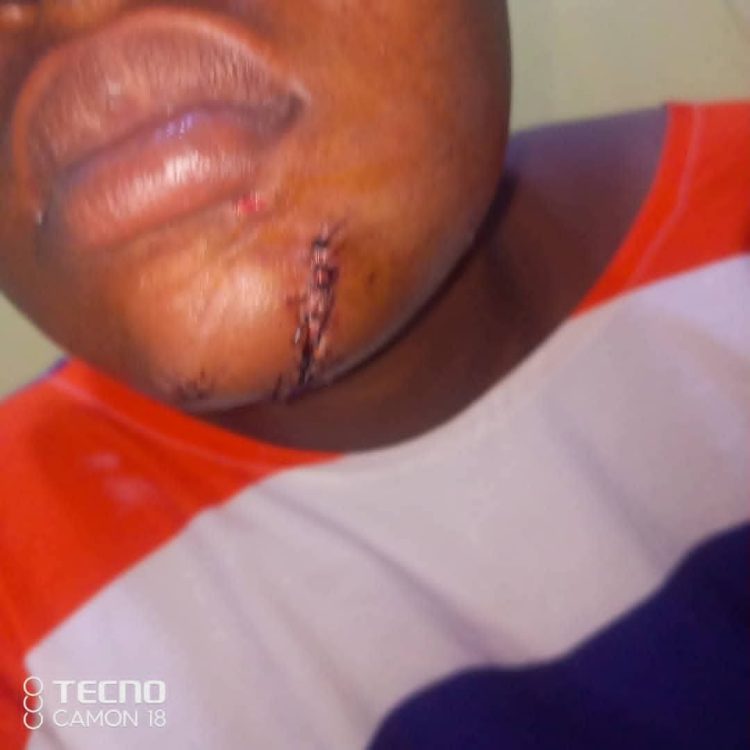 Kasoa: Gold dealer ‘hammers’ girlfriend to near-death over suspected infidelity