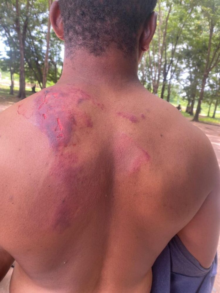 BE/R: Macho men assault farmers in Amantin