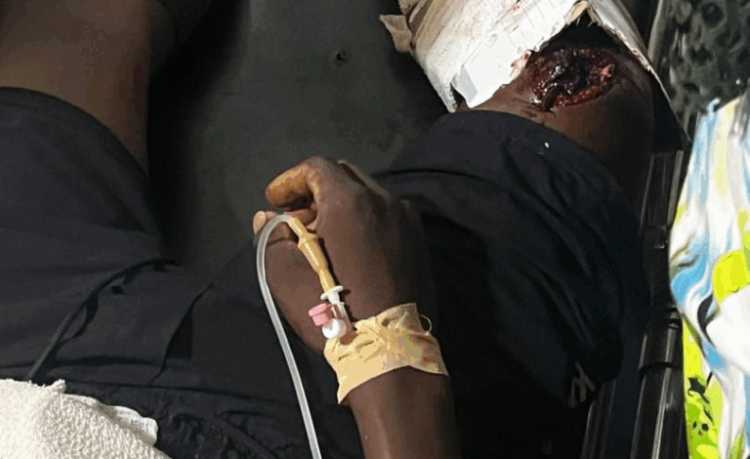 UE/R: Two immigration officers shot in Tempane