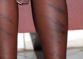 11-year-old pupil left with severe bruises after teacher subjects him to merciless caning